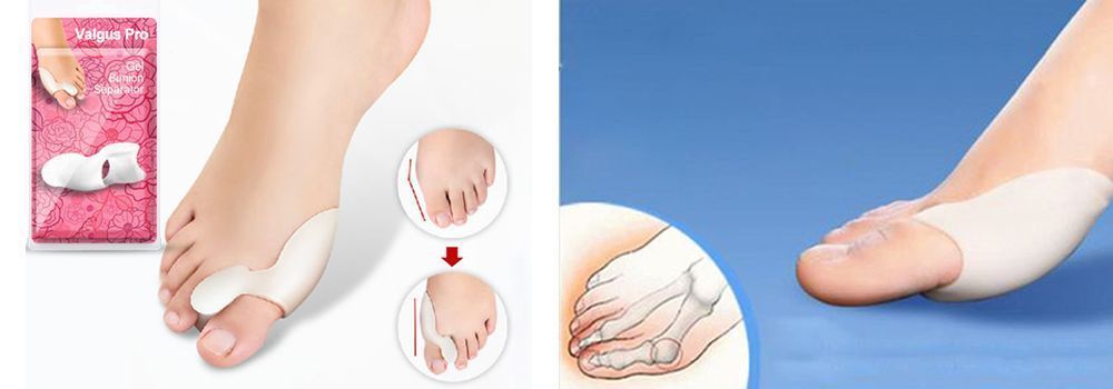 Фиксатор для косточек на ногах Вальгус Про (Valgus Pro) Фиксатор для косточек на ногах Вальгус Про (Valgus Pro)